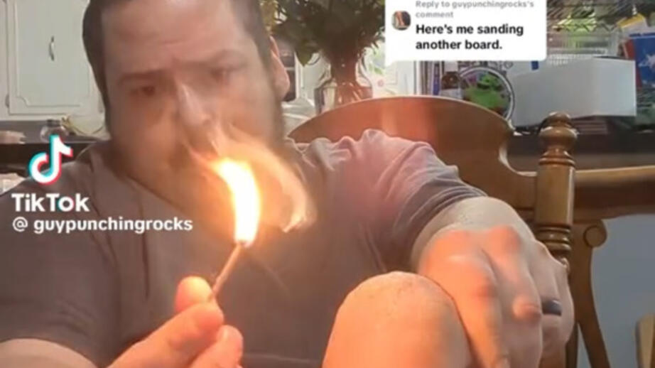 Influeraren Guy Punching Rocks använder hundmedicin på kroppen. 