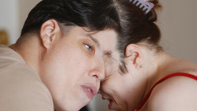 CONJOINED TWINS REAX. Foto: John A. Secoges